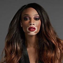 Winnie Harlow